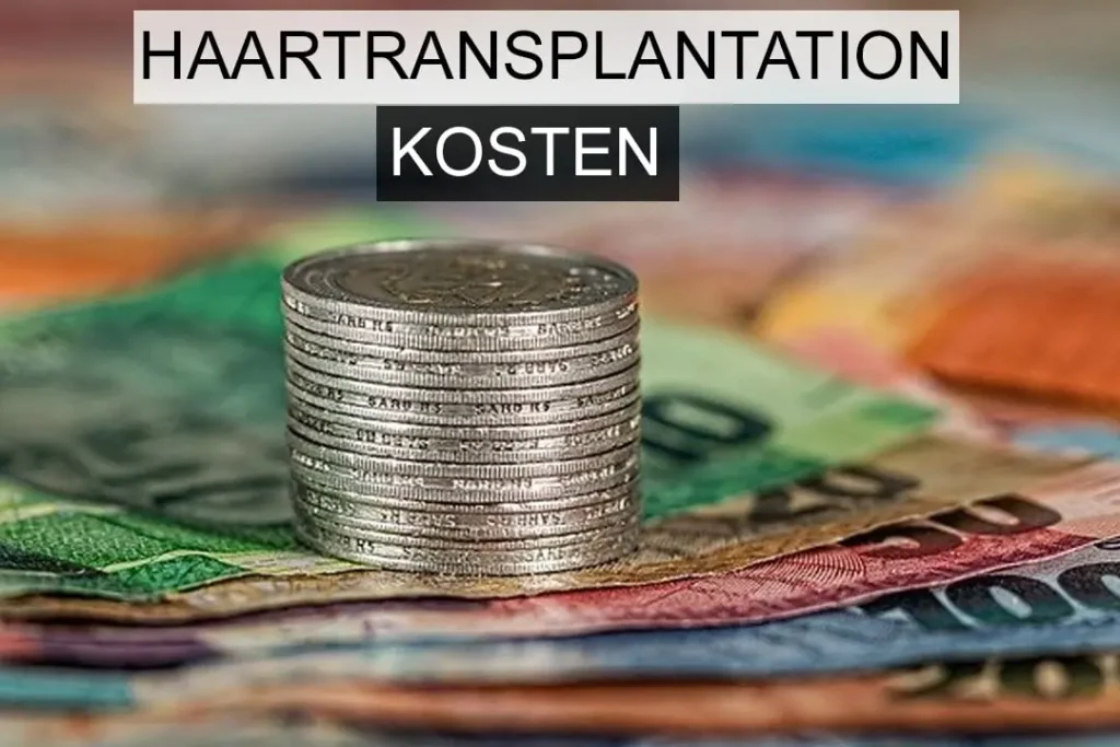 Haartransplantation Kosten & Preise Österreich, Wien und europäischen Ländern 